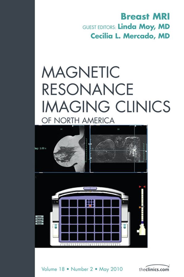 Breast MRI, An Issue of Magnetic Resonance Imaging Clinics - E-Book