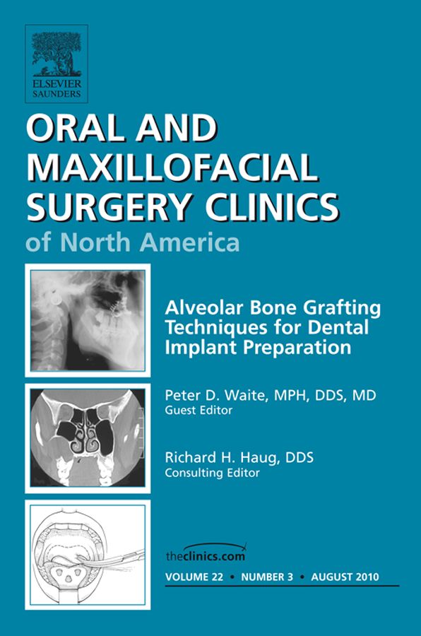 Alveolar Bone Grafting Techniques in Dental Implant Preparation, An Issue of Oral and Maxillofacial Surgery Clinics - E-Book