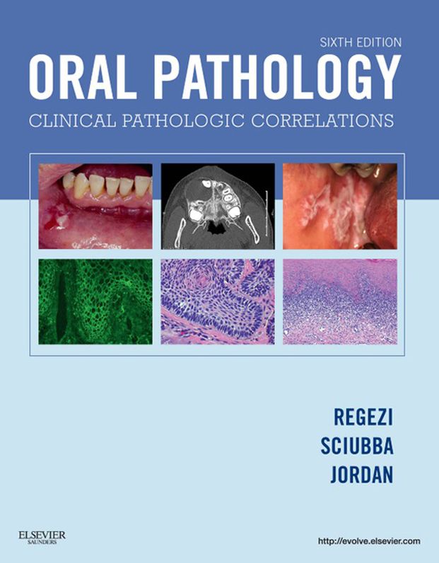 Oral Pathology - E-Book: Oral Pathology - E-Book
