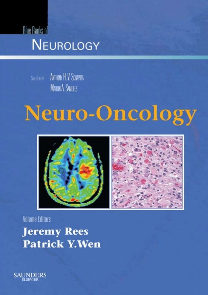 Neuro-Oncology E-Book: Blue Books of Neurology Series