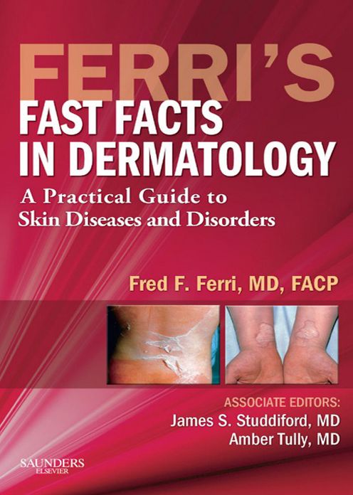 Ferri's Fast Facts in Dermatology E-Book: A Practical Guide to Skin Diseases and Disorders