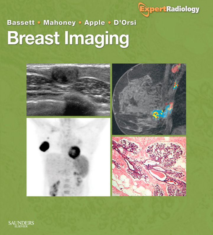 Breast Imaging Expert Radiology Series E-Book