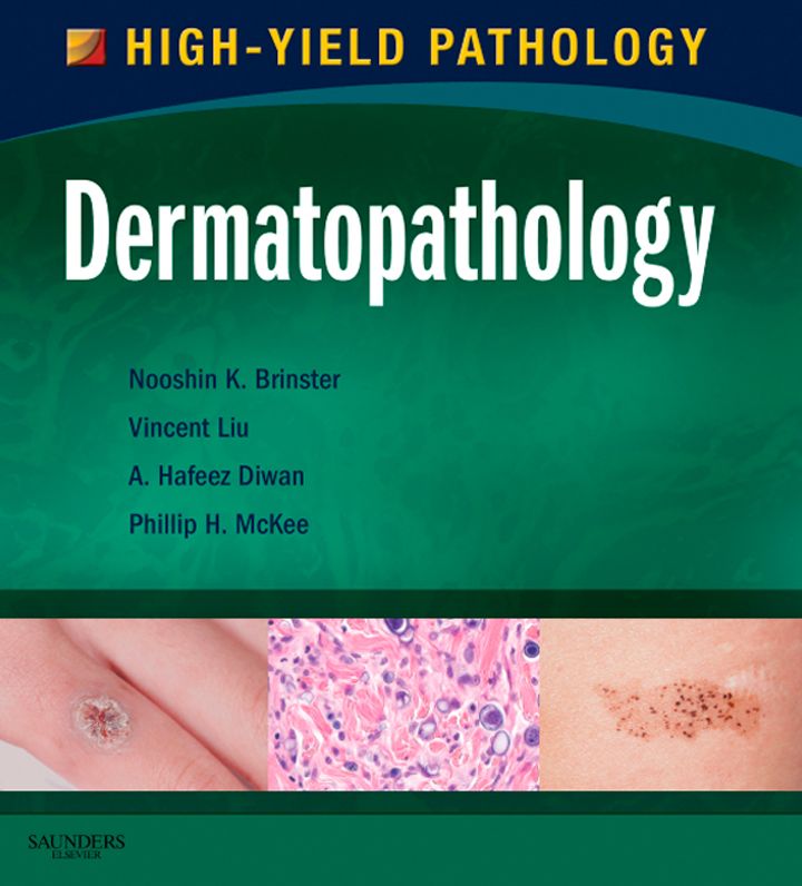 Dermatopathology E-Book: A Volume in the High Yield Pathology Series