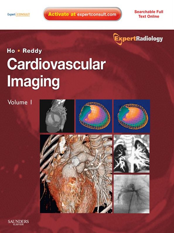 Cardiovascular Imaging E-Book