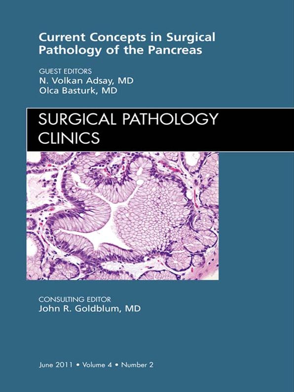 Surgical Pathology of the Pancreas, An Issue of Surgical Pathology Clinics - E-Book