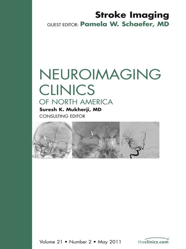 Stroke Imaging Update, An Issue of Neuroimaging Clinics - E-Book