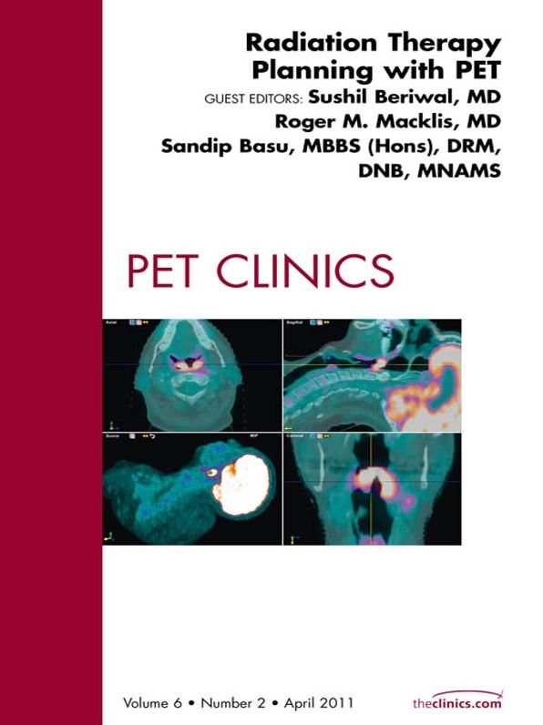 Radiation Therapy Planning, An Issue of PET Clinics - E-Book
