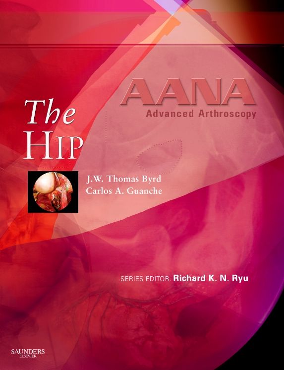 AANA Advanced Arthroscopy: The Hip E-Book