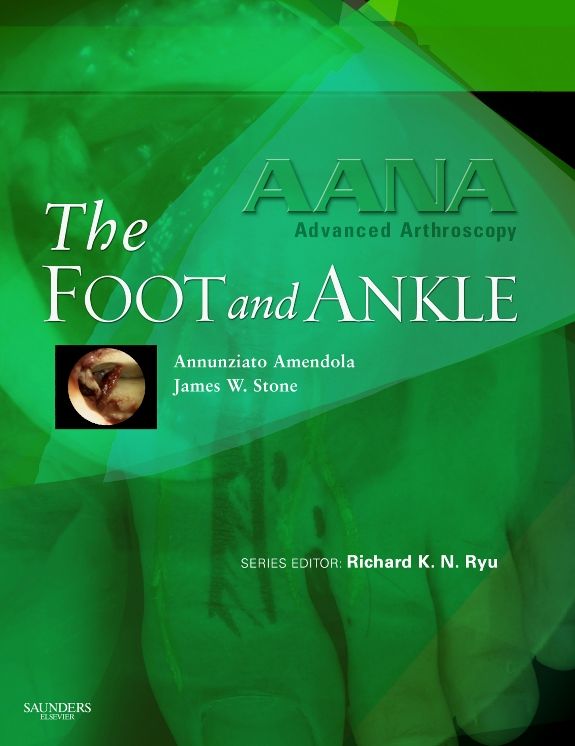 AANA Advanced Arthroscopy: The Foot and Ankle E-Book