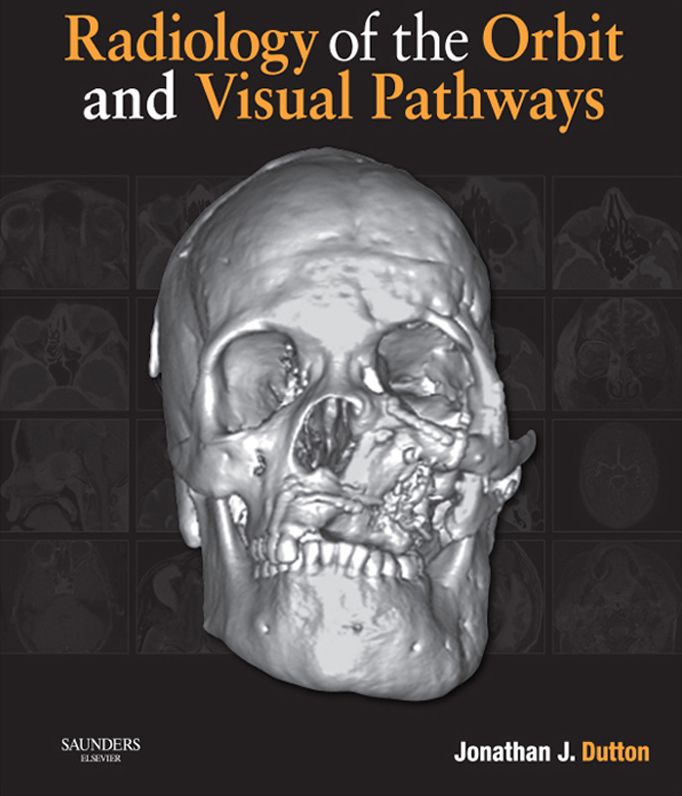 Radiology of the Orbit and Visual Pathways E-Book
