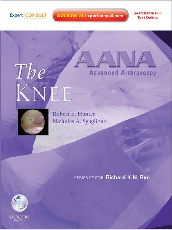 AANA Advanced Arthroscopy: The Knee E-Book