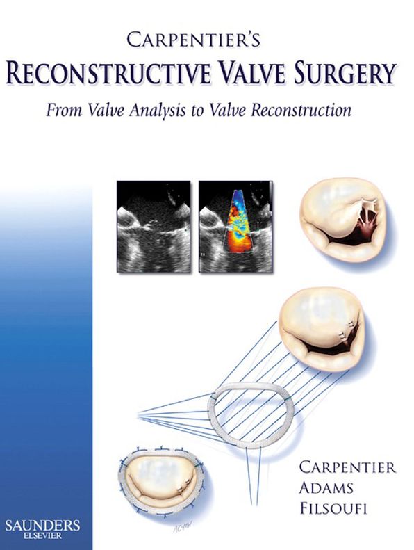 Carpentier's Reconstructive Valve Surgery E-Book
