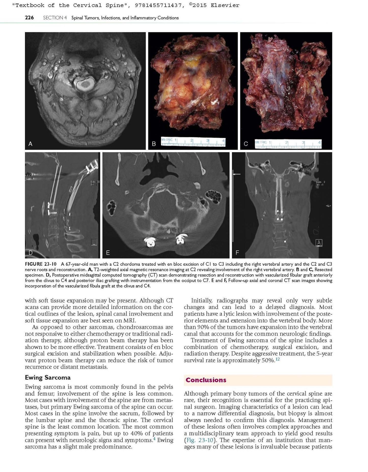 Textbook of the Cervical Spine
