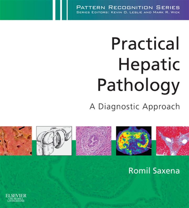 Practical Hepatic Pathology: A Diagnostic Approach E-Book: A Volume in the Pattern Recognition Series