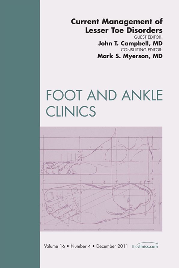 Current Management of Lesser Toe Deformities, An Issue of Foot and Ankle Clinics - E-Book