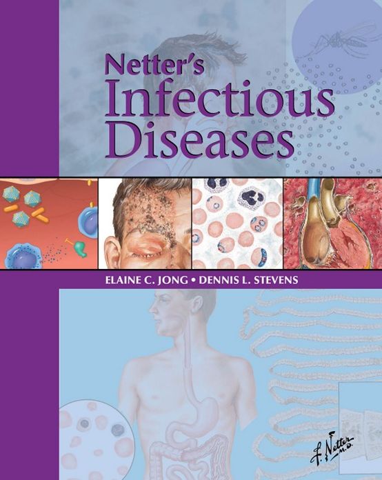 Netter's Infectious Diseases E-Book