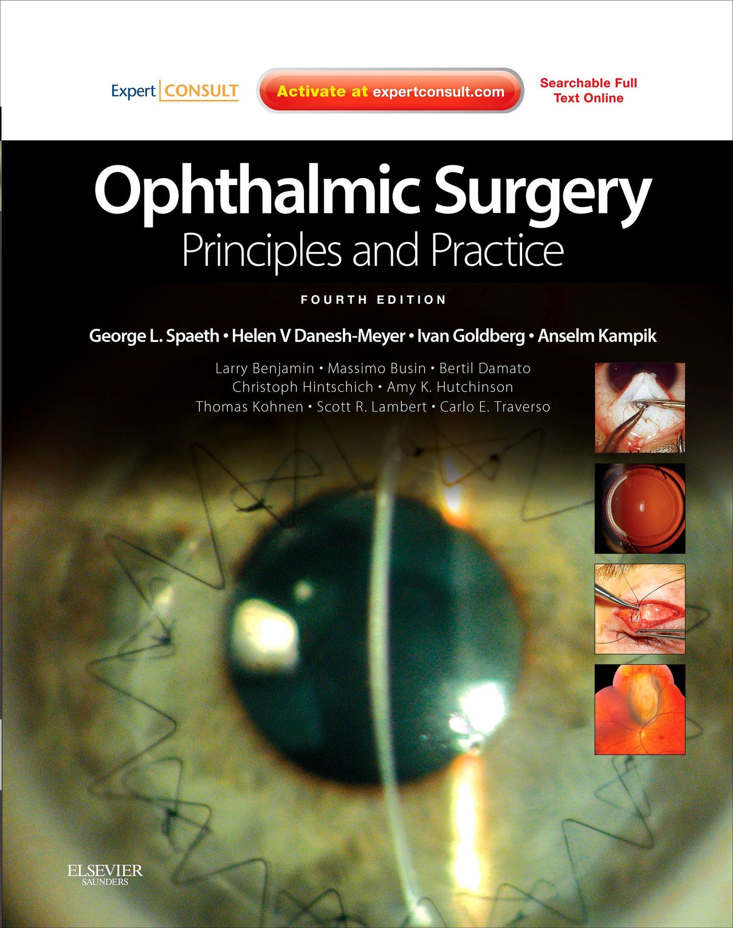 Ophthalmic Surgery: Principles and Practice E-Book