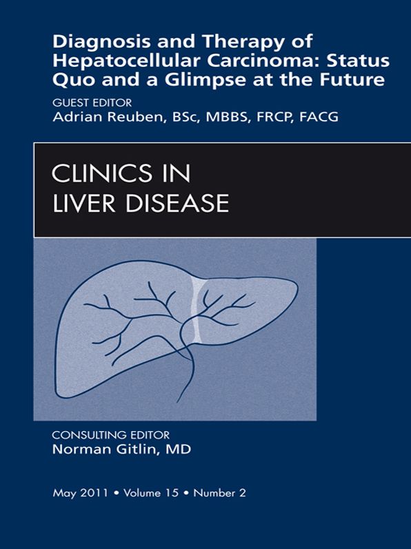 Hepatocellular Carcinoma, An Issue of Clinics in Liver Disease - E-Book