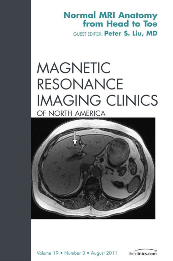 Normal MR Anatomy, An Issue of Magnetic Resonance Imaging Clinics - E-Book