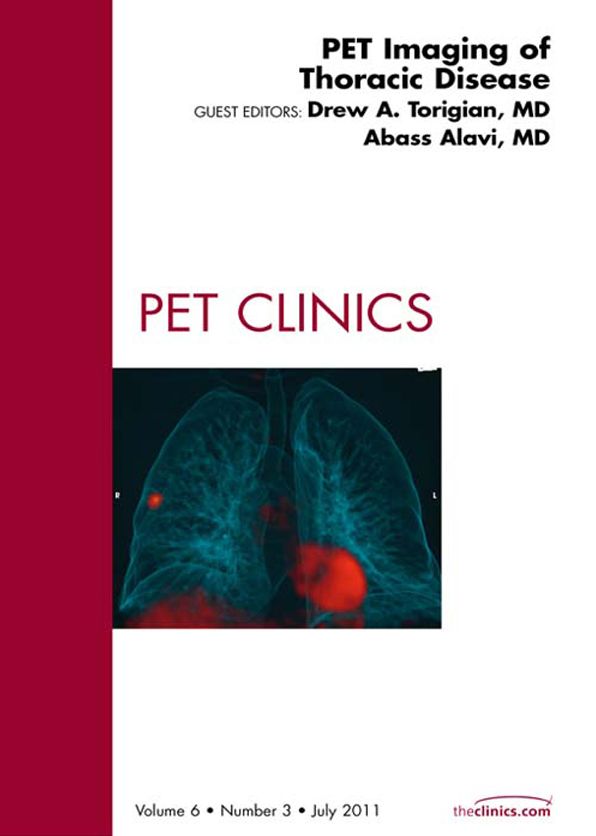 PET Imaging of Thoracic Disease, An Issue of PET Clinics - E-Book