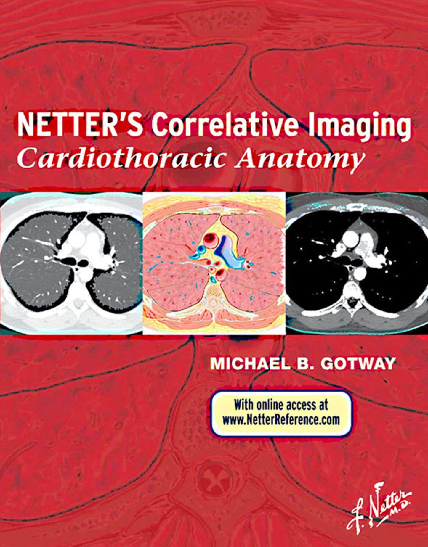 Netter's Correlative Imaging: Cardiothoracic Anatomy E-Book