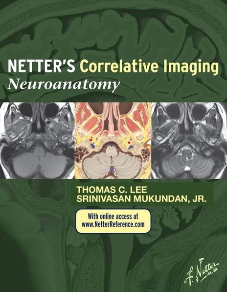 Netter's Correlative Imaging: Neuroanatomy E-Book