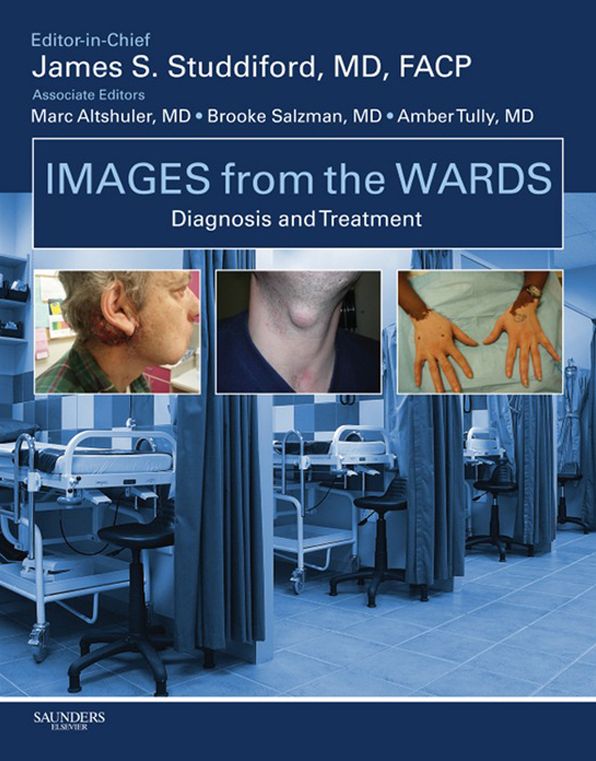 Images from the Wards: Diagnosis and Treatment E-Book