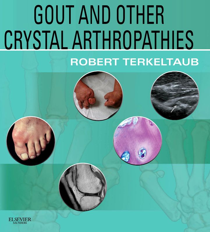 Gout & Other Crystal Arthropathies E-Book