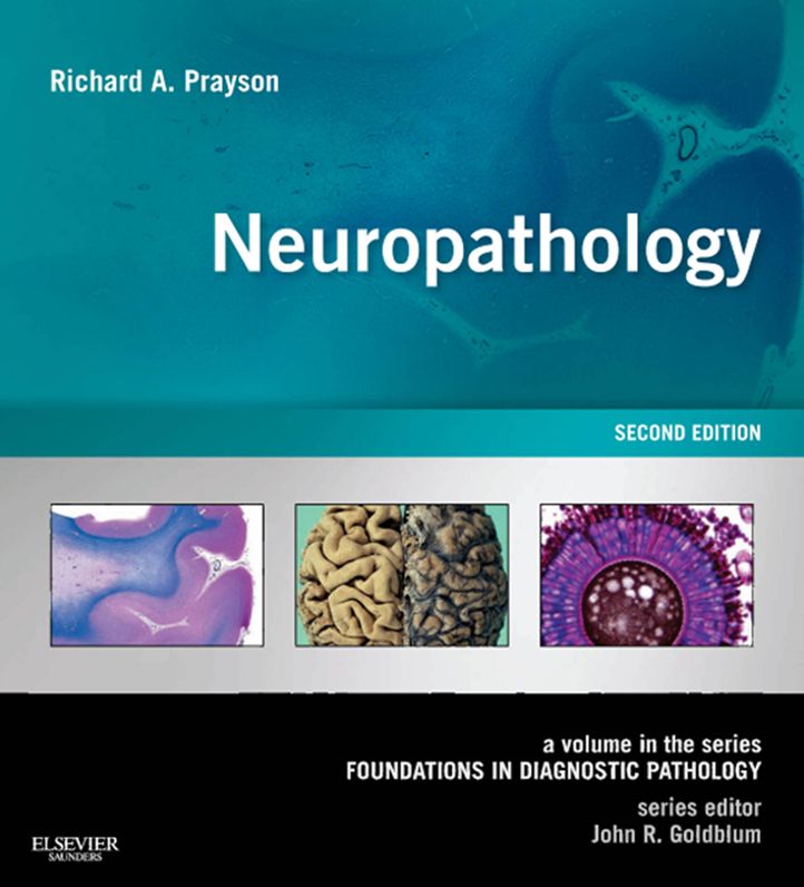 Neuropathology E-Book: A Volume in the Series: Foundations in Diagnostic Pathology