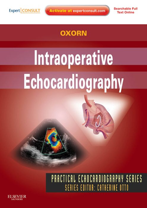 Intraoperative Echocardiography- E-BOOK