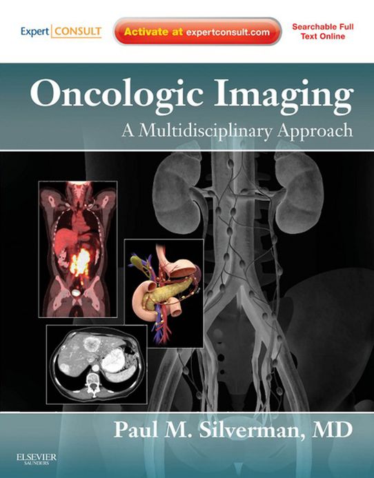 Oncologic Imaging: A Multidisciplinary Approach E-Book: Expert Consult - Online and Print