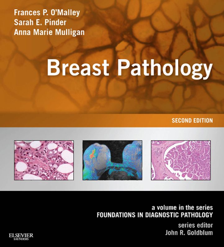Breast Pathology E-Book: A Volume in the Series: Foundations in Diagnostic Pathology