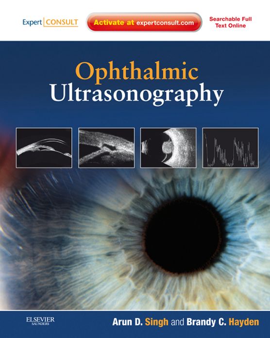 Ophthalmic Ultrasonography E-Book: Expert Consult - Online and Print
