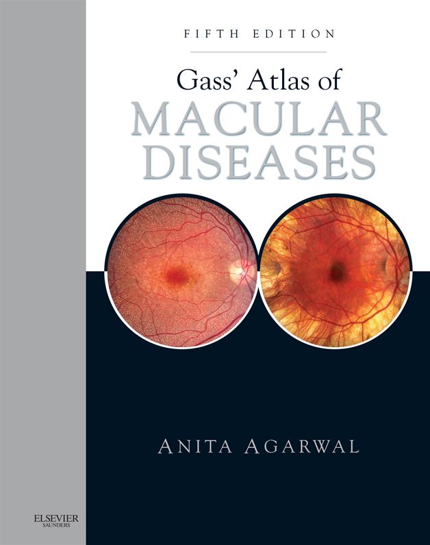 Gass' Atlas of Macular Diseases E-Book