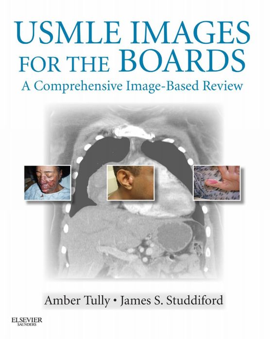 USMLE Images for the Boards E-Book: A Comprehensive Image-Based Review