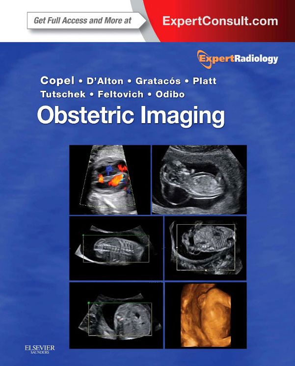 Obstetric Imaging E-Book: Expert Radiology Series