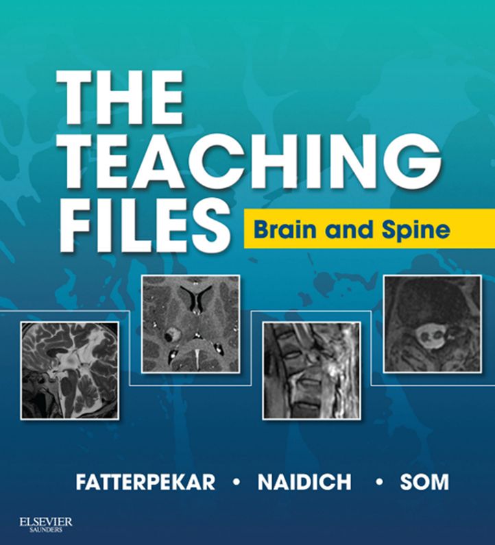 The Teaching Files: Brain and Spine Imaging E-Book