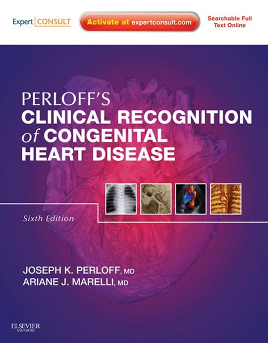Clinical Recognition of Congenital Heart Disease E-Book