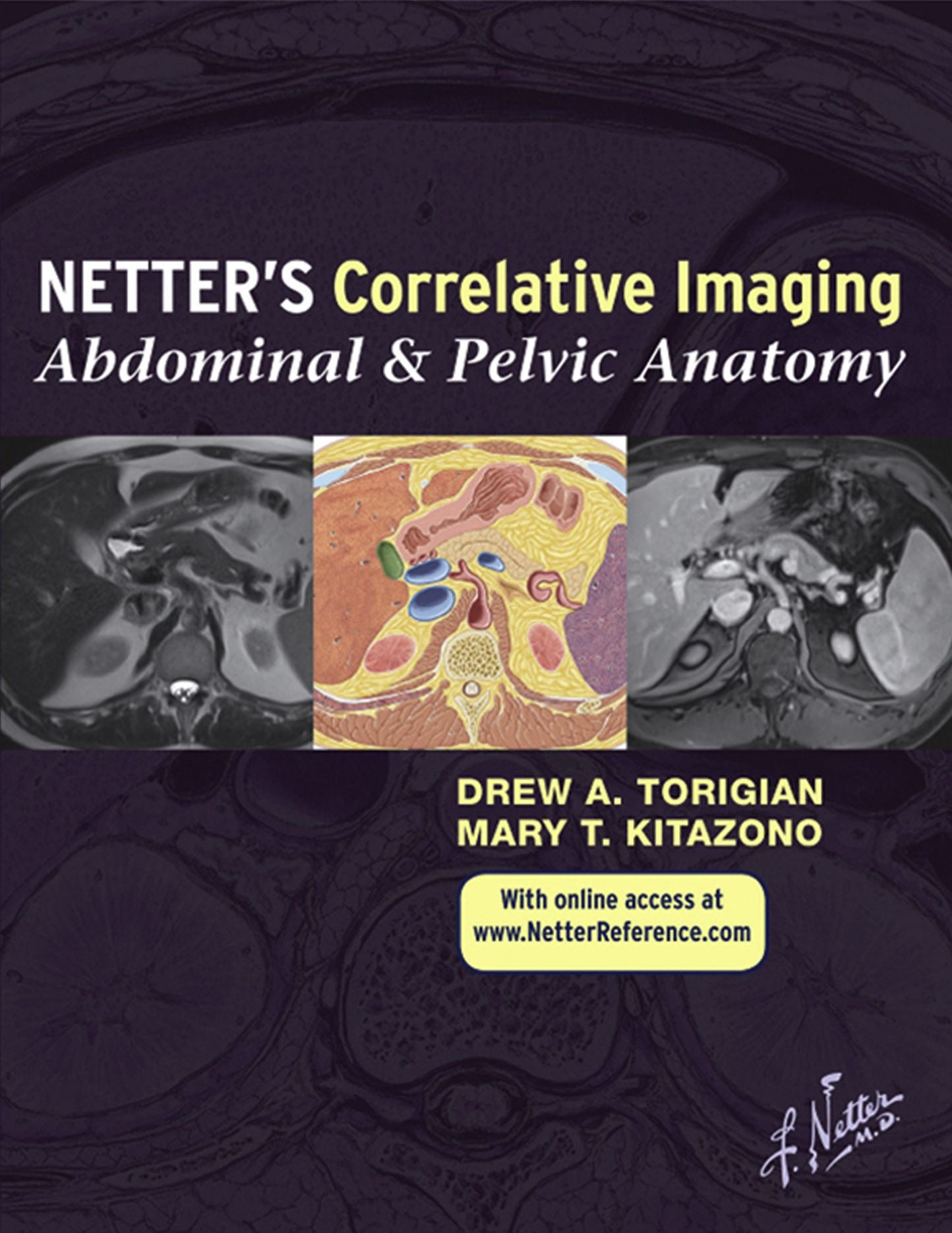 Netter's Correlative Imaging: Abdominal and Pelvic Anatomy e-Book: with Online Access
