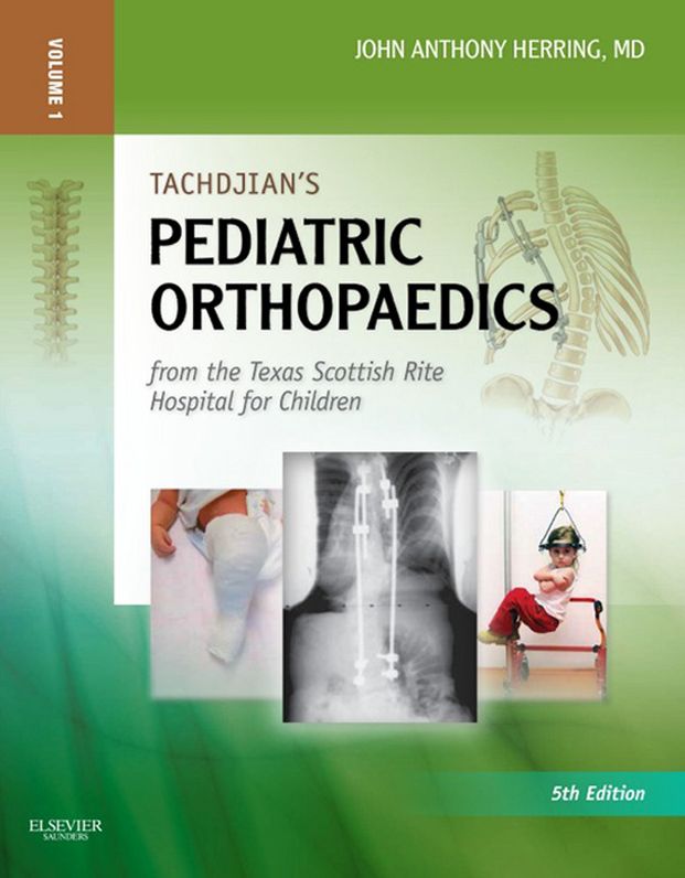 Tachdjian's Pediatric Orthopaedics E-Book: From the Texas Scottish Rite Hospital for Children
