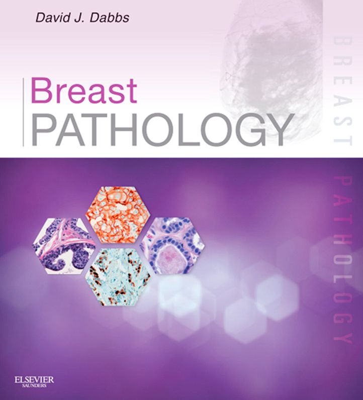 Breast Pathology E-Book