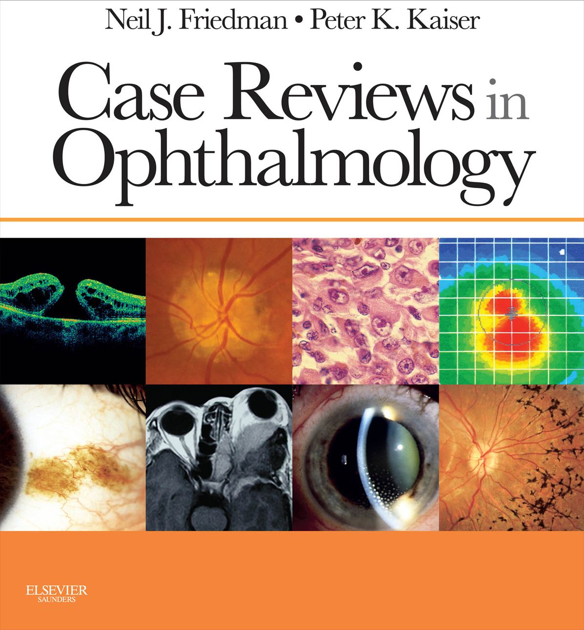 Case Reviews in Ophthalmology E-Book