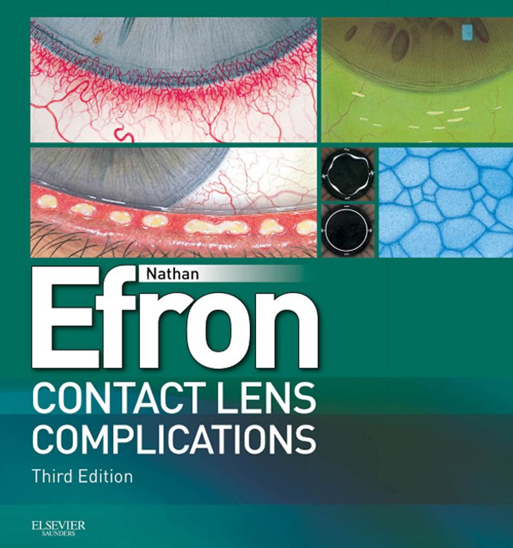 Contact Lens Complications E-Book