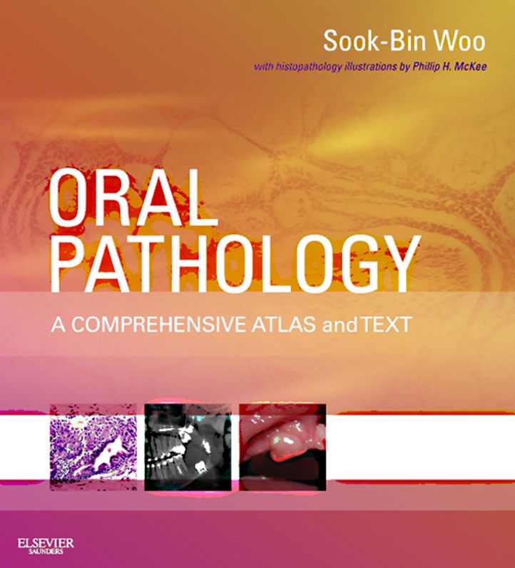 Oral Pathology E-Book: A Comprehensive Atlas and Text