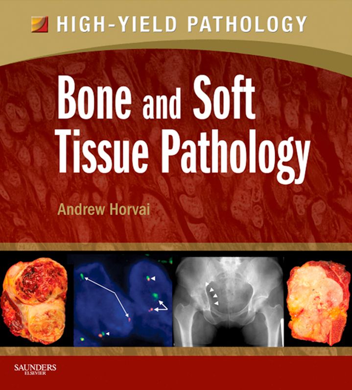 Bone and Soft Tissue Pathology E-Book: A Volume in the High Yield Pathology Series