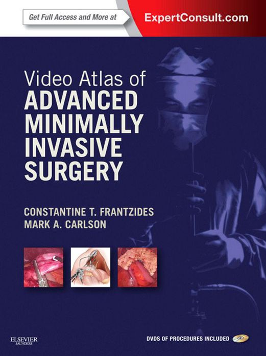 Video Atlas of Advanced Minimally Invasive Surgery E-Book: Expert Consult - Online