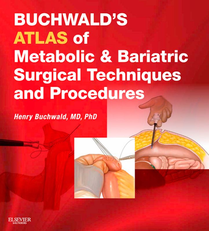 Buchwald's Atlas of Metabolic & Bariatric Surgical Techniques and Procedures E-Book