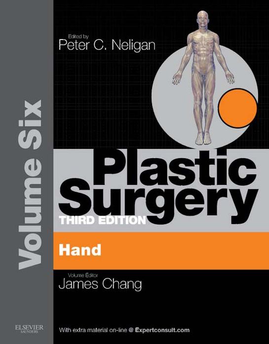 Plastic Surgery E-Book: Volume 6: Hand and Upper Limb (Expert Consult - Online)