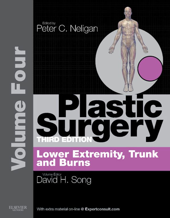 Plastic Surgery E-Book: Volume 4: Trunk and Lower Extremity (Expert Consult - Online)