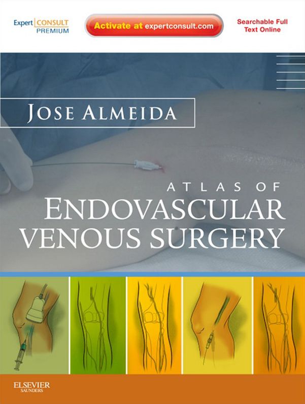 Atlas of Endovascular Venous Surgery E-Book: Expert Consult - Online